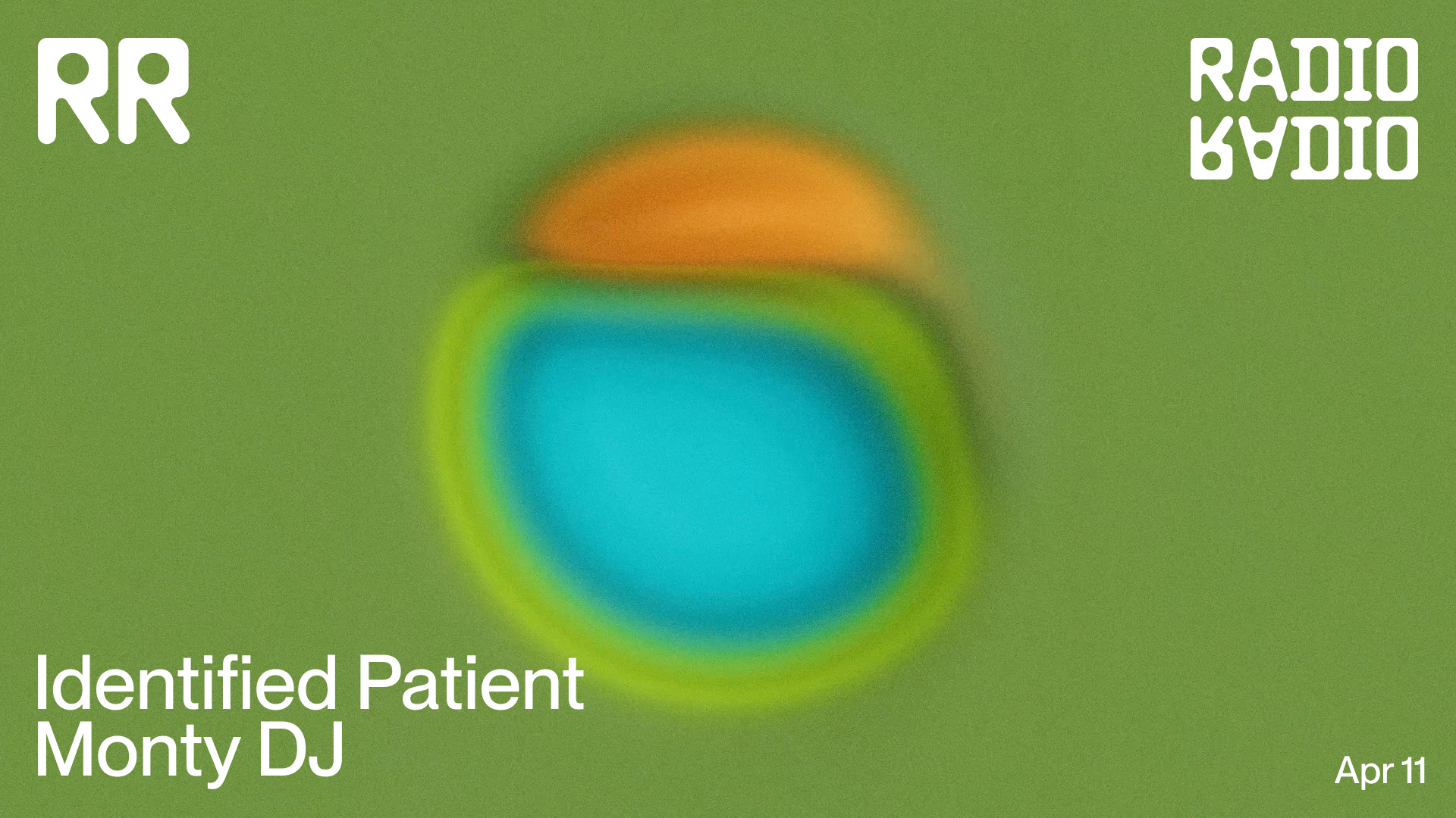 Identified Patient • Monty DJ